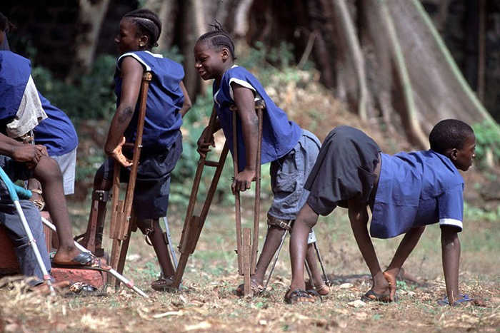 Children-living-with-Polio